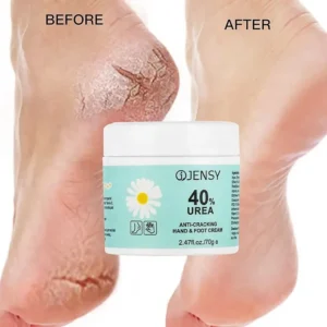 Urea Foot Cream 1